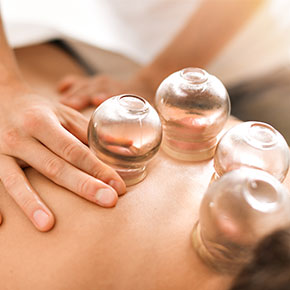 massage therapist placing cups to patient's back