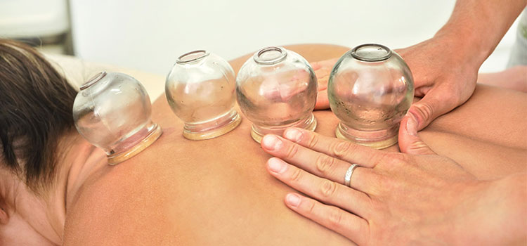 patient with cupping technique applied to back