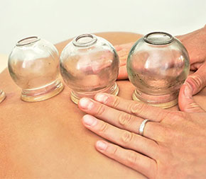 patient receiving cupping therapy